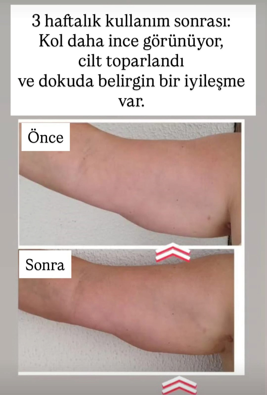 Greyfurtlu Lenf Drenajli Vücut Losyonu